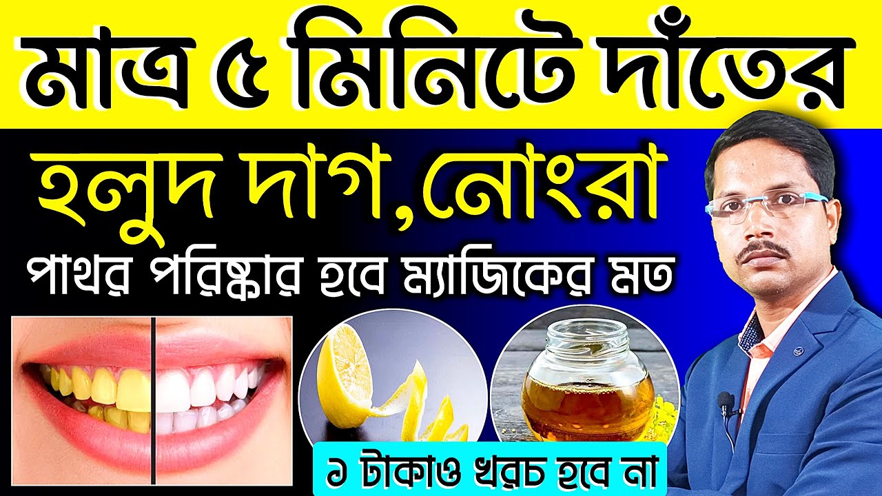 মাত্র ৫ মিনিটে দাঁতের হলুদ দাগ, নোংরা, পাথর পরিষ্কার হবে ম্যাজিকের মত | দাঁত সাদা করার সহজ উপায় |