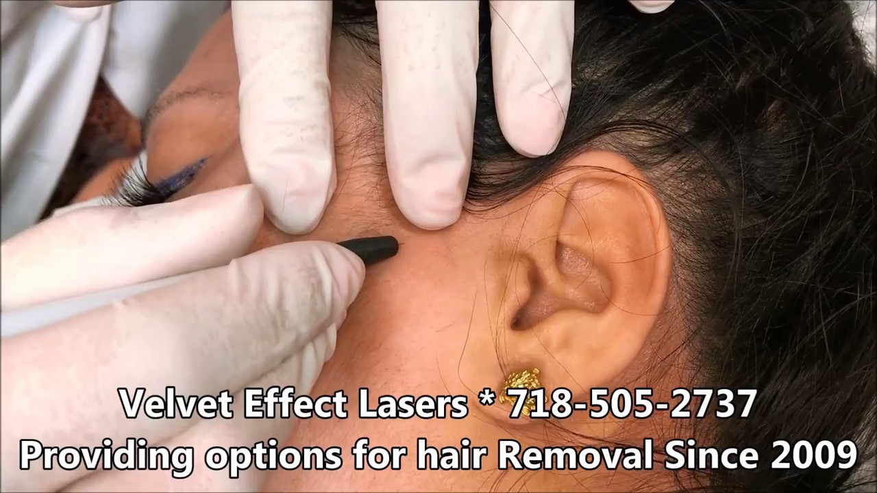 Electrolysis - Video #19
