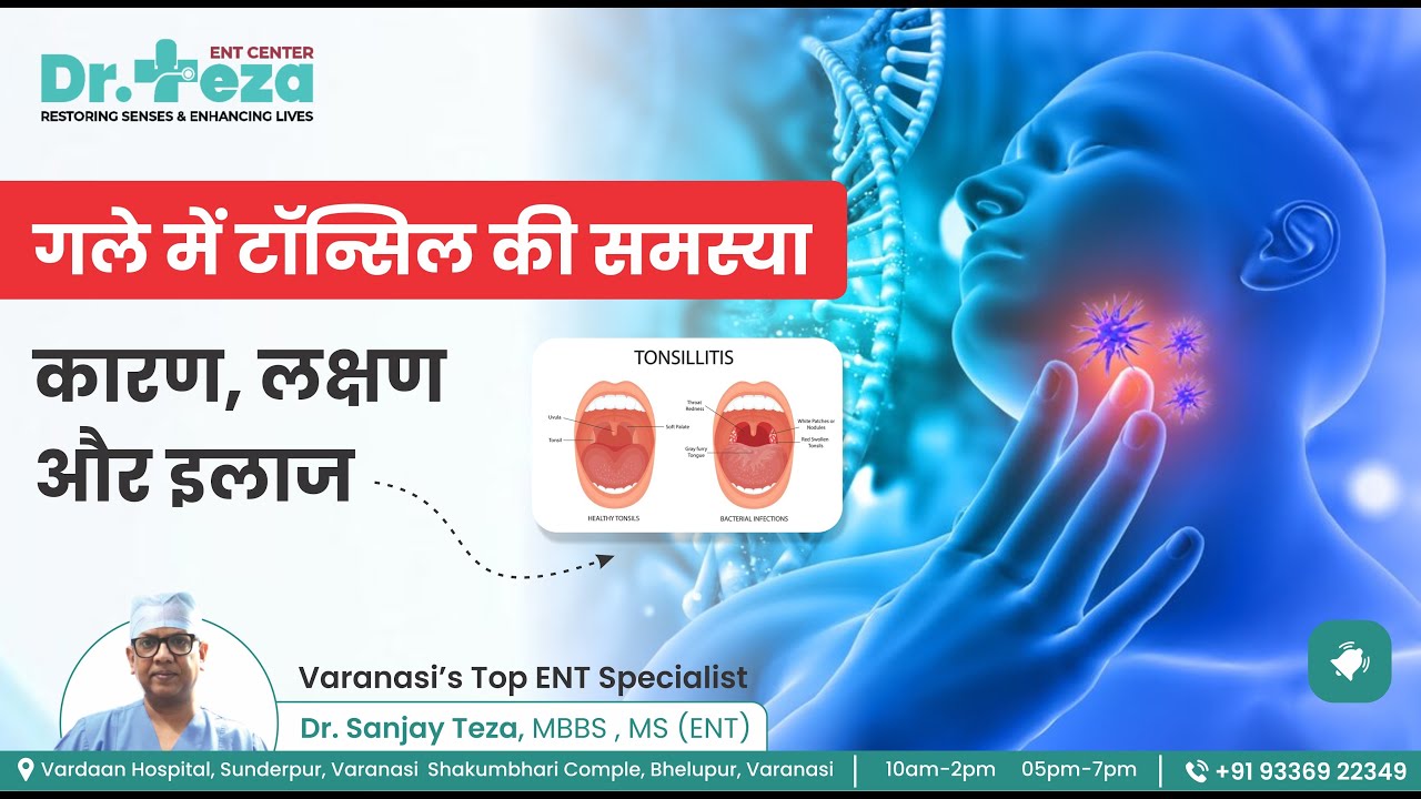 Tonsilliti| Causes, Symptoms & Treatment | गले में टॉन्सिल की समस्या? कारण, लक्षण और इलाज| Dr Sanjay