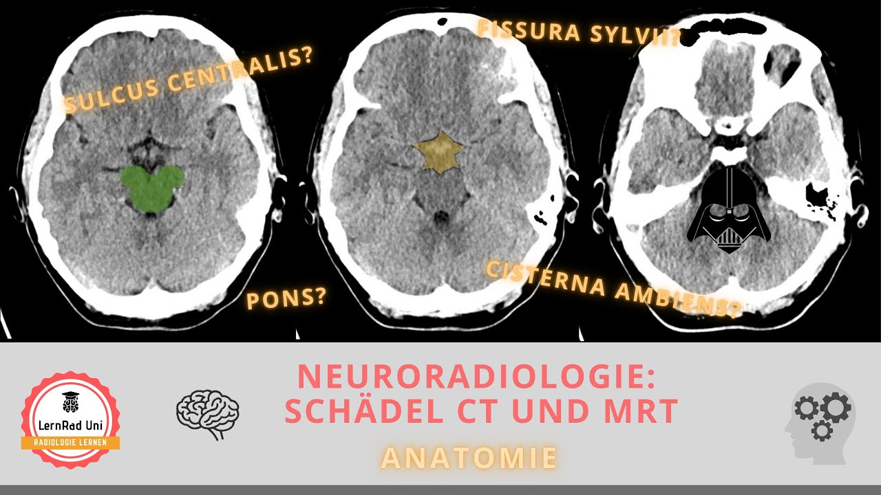 Anatomie verstehen: Schädel im CT & MRT systematisch erklärt