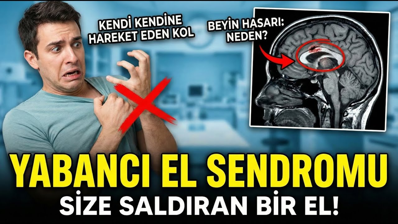 Yabancı El Sendromu: Kendi Kendine Hareket Eden ve Size Saldıran Bir Kol