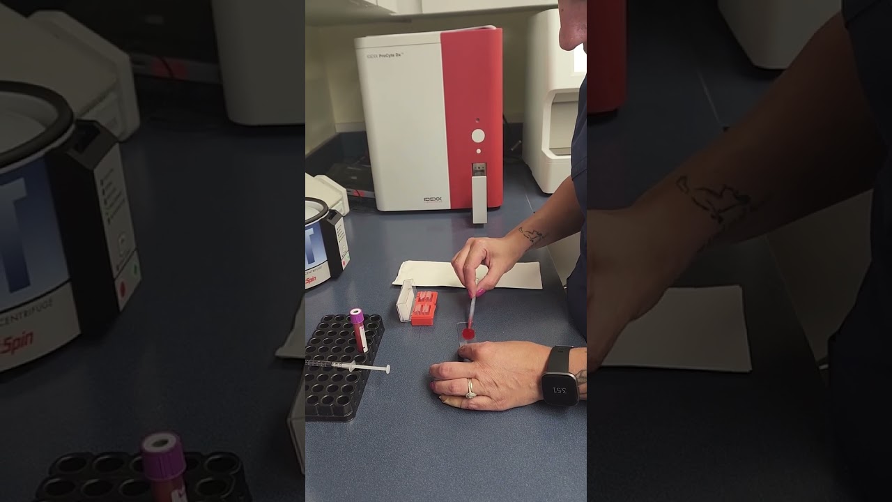 Saline Agglutination Test