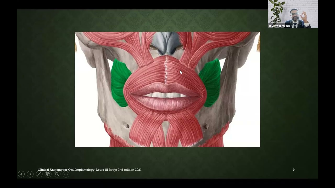 Anatomical considerations in implant surgery dr vishwas madan impalnt lecture for dentists