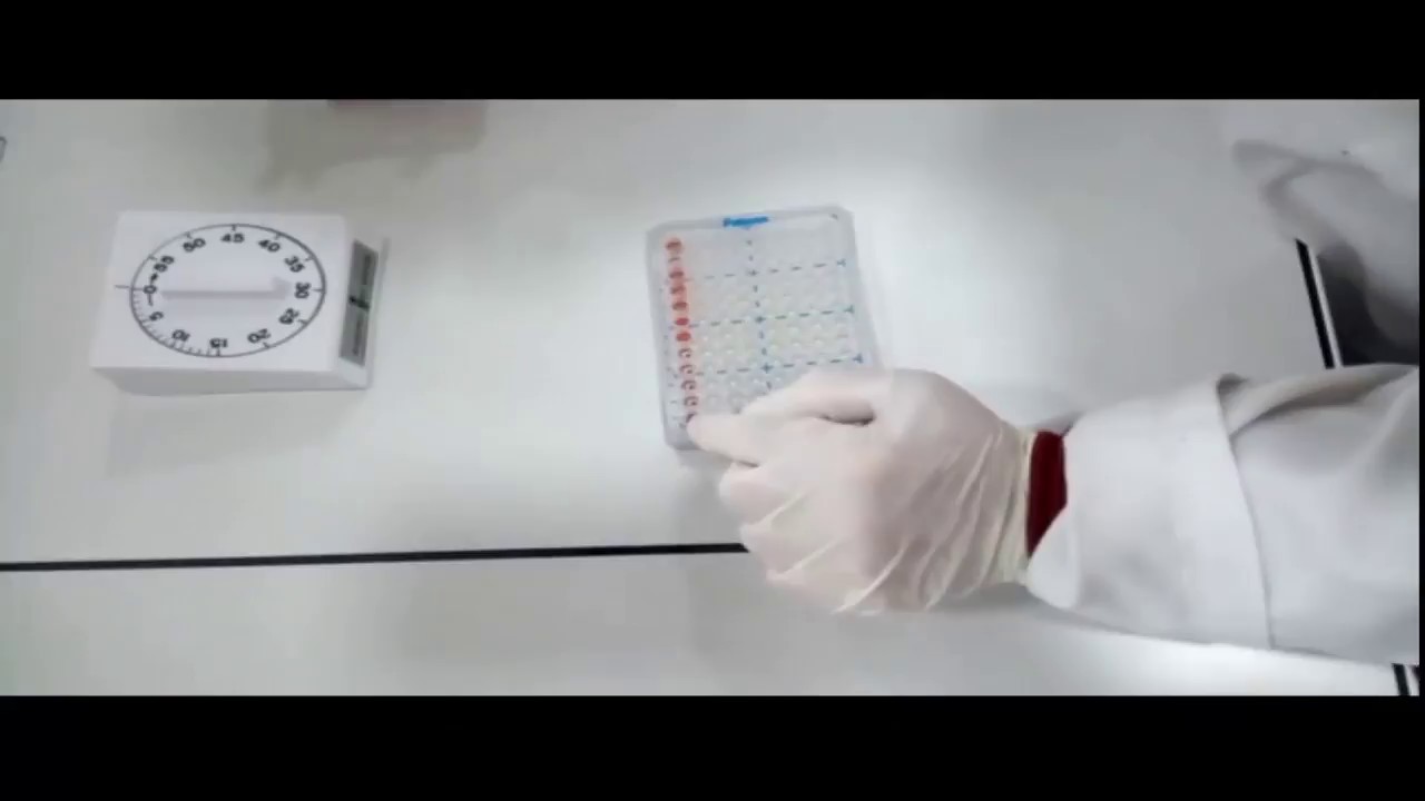 titrage des anti streptolysines 