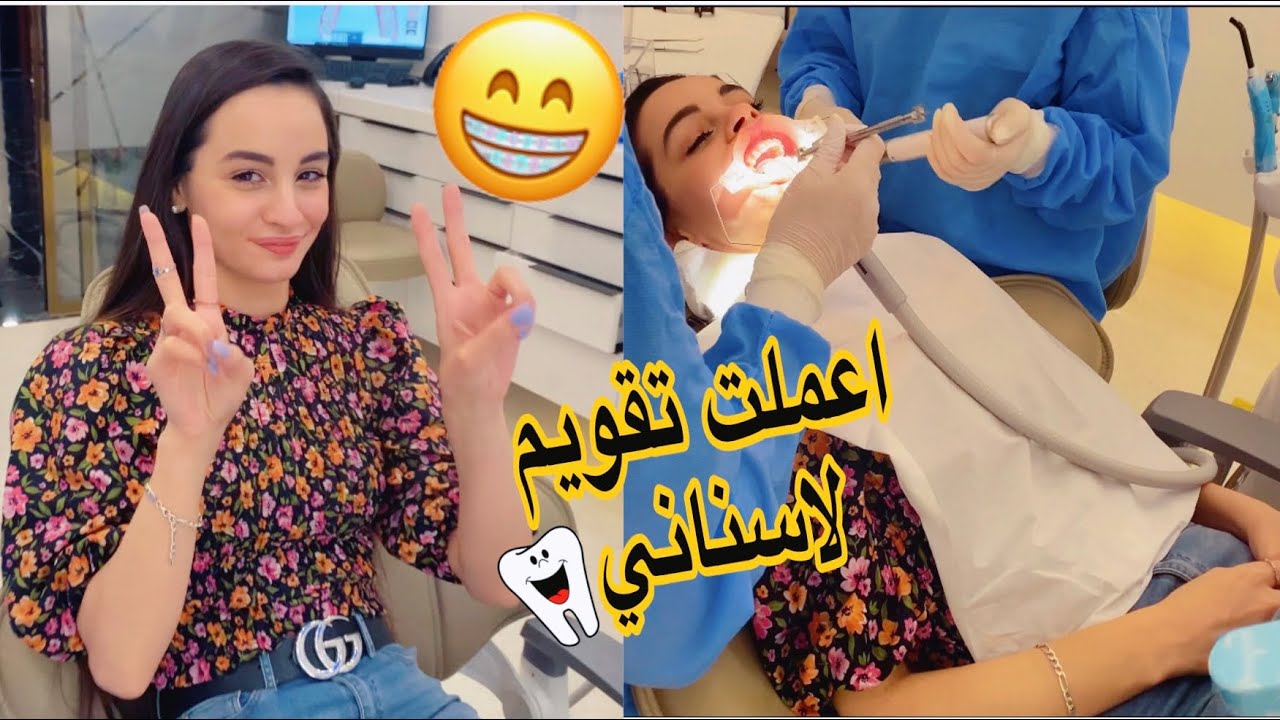 عملت تقويم لاسناني 😁🦷 وكنت كتييير خايفة 😟