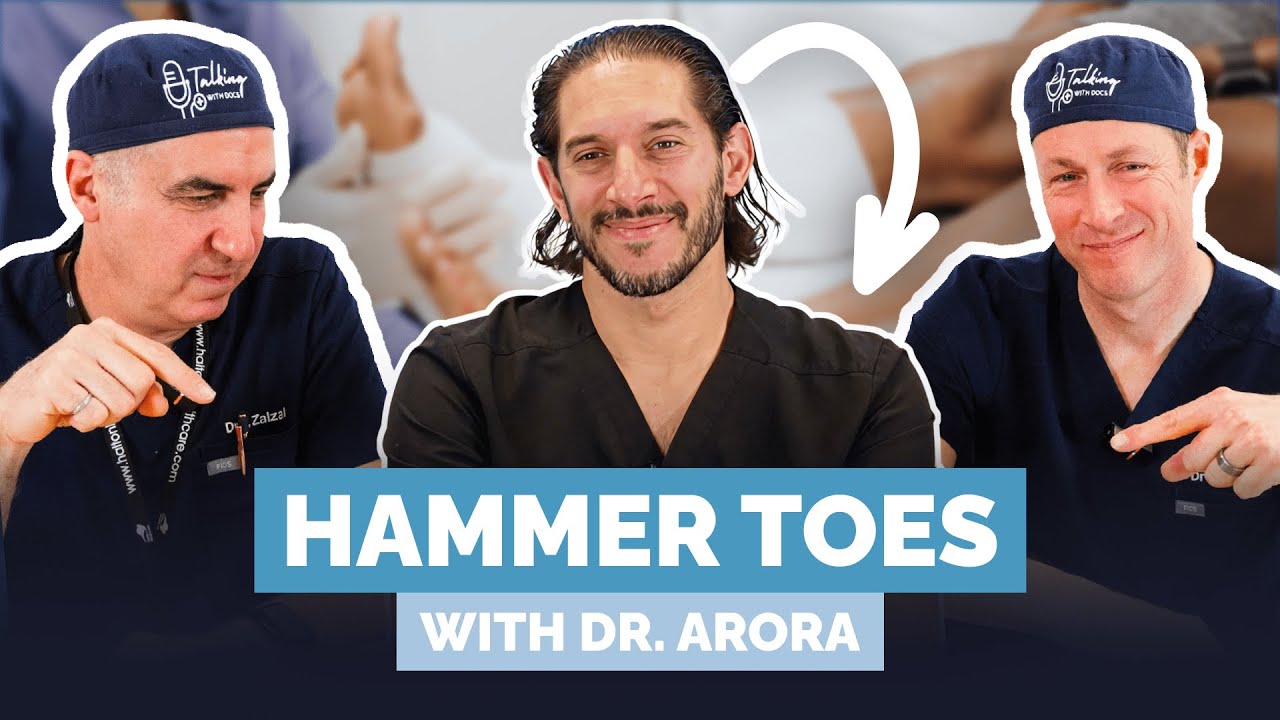 Why Are Your Toes Curling Like This? Doctor Explains Hammer Toe