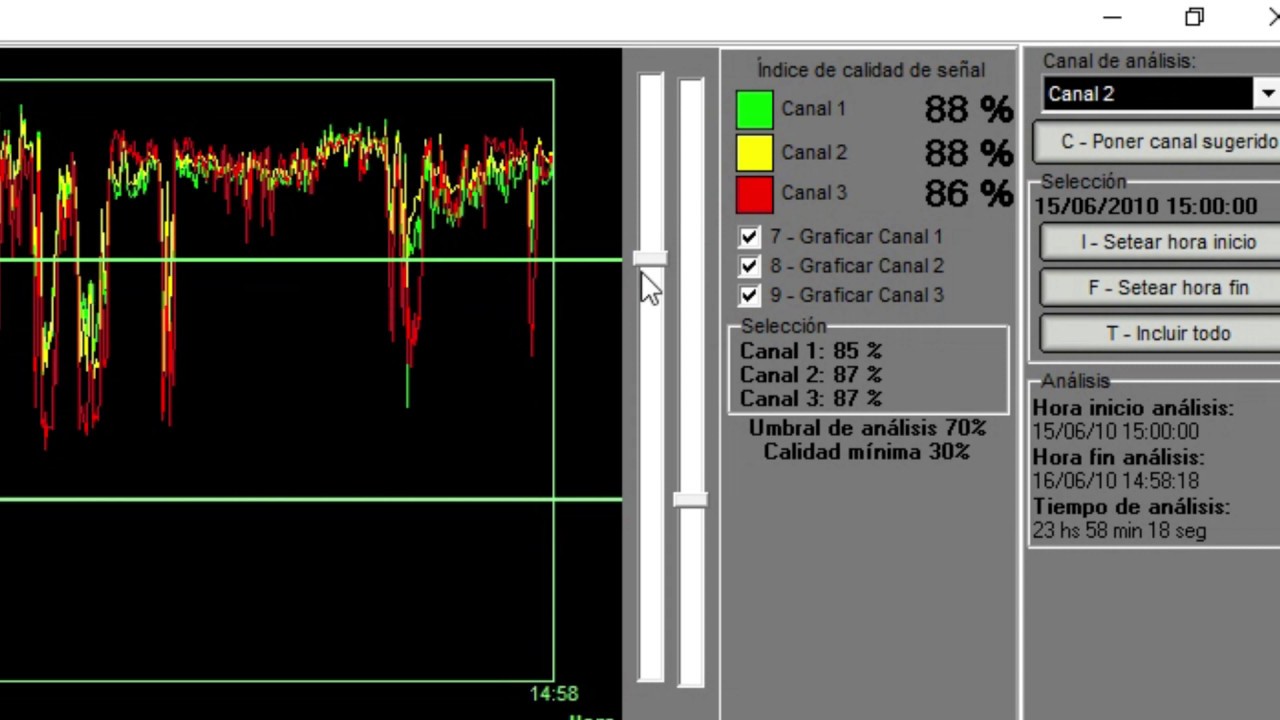4. Módulo 4 - Holter HT-103: Pantalla, Descarga y Procesamiento de Señal | Análisis Completo ECCOSUR