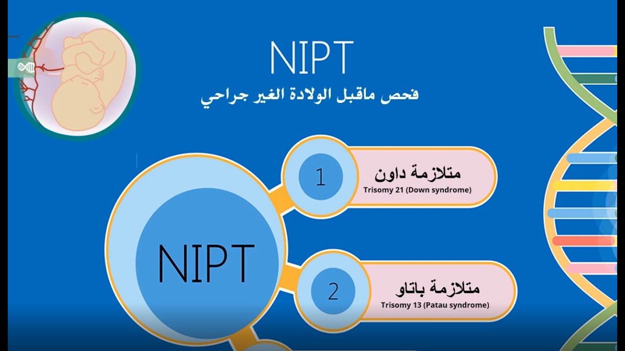 فحص ماقبل الولادة غير الجراحي للكشف عن تشوهات الجنين  |  NIPT
