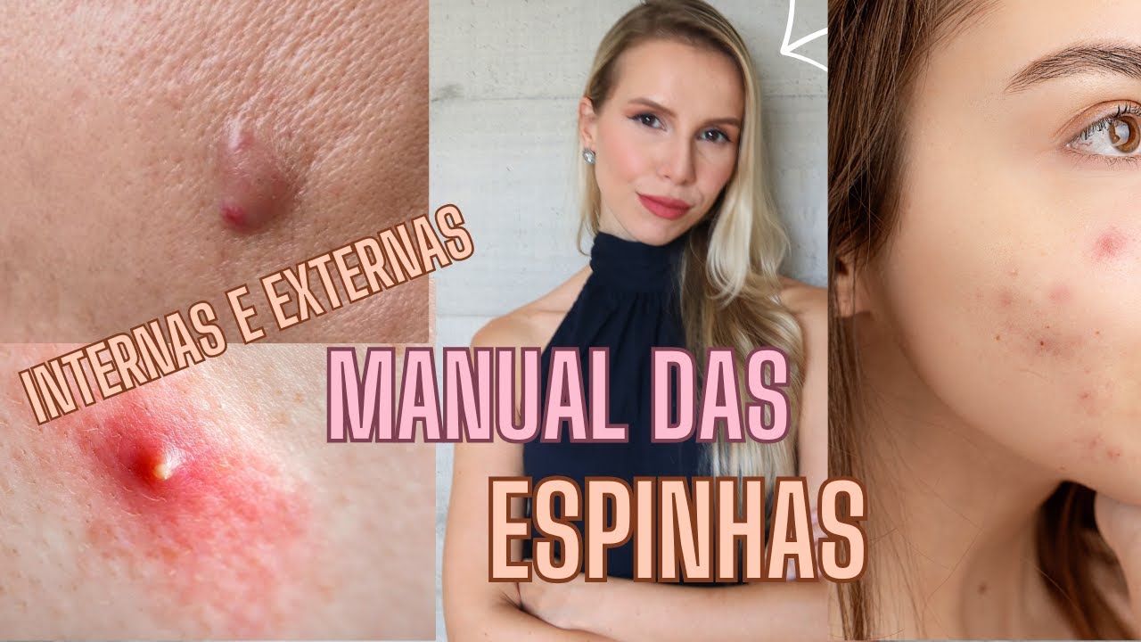 MANUAL DAS ESPINHAS  INTERNAS E EXTERNAS -  Bruna Harmel