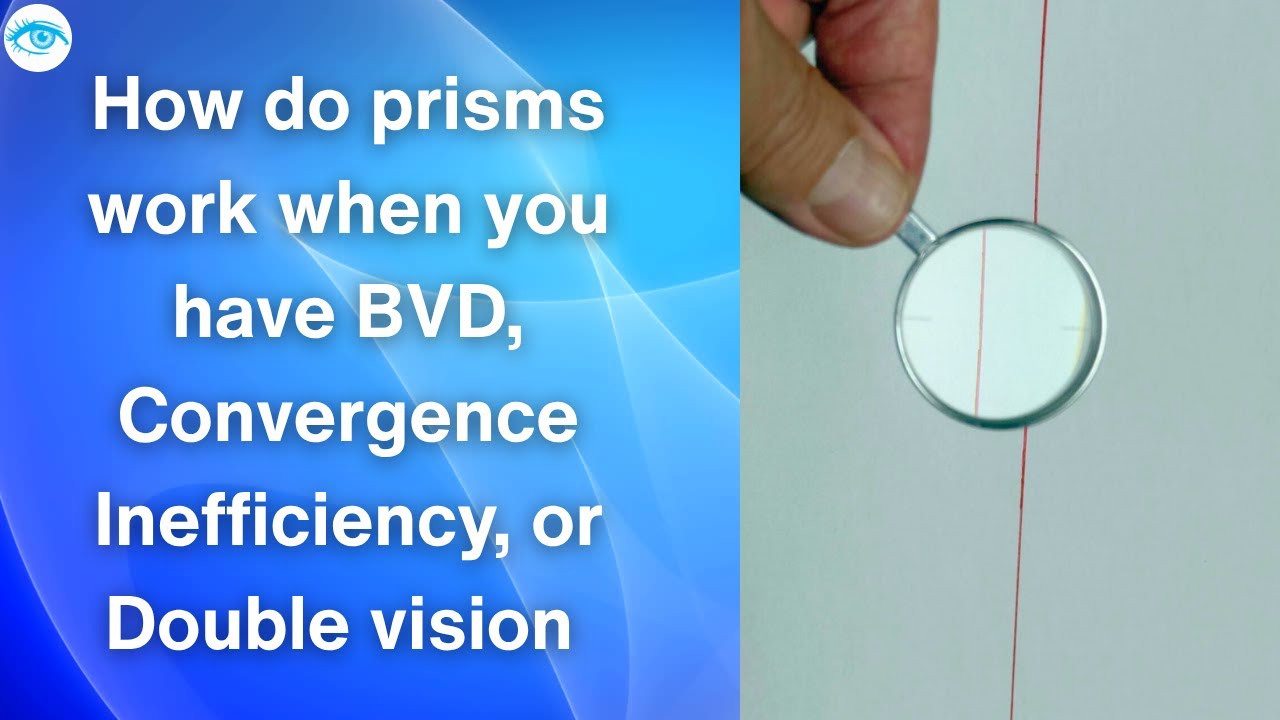 @eyeoptometrist  How does prisms work when you have BVD, Convergence Inefficiency or Double vision 