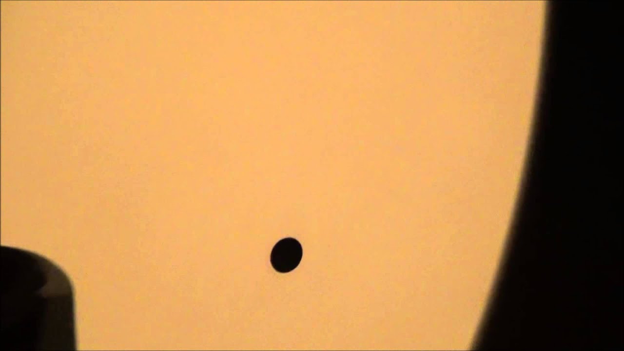 Campo Visual - Campimetria