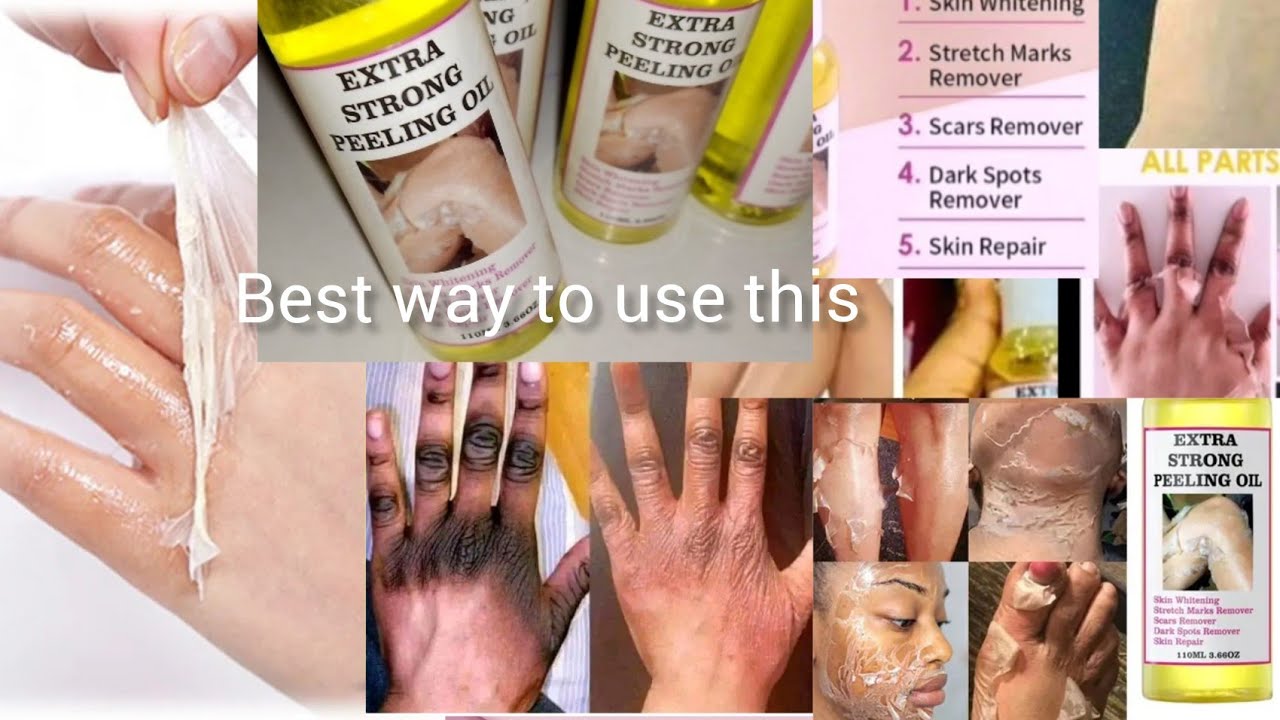 PEELING OIL THE BEST WAY TO USE THIS OIL FOR BEST RESULT WITHOUT DAMAGING YOUR SKIN