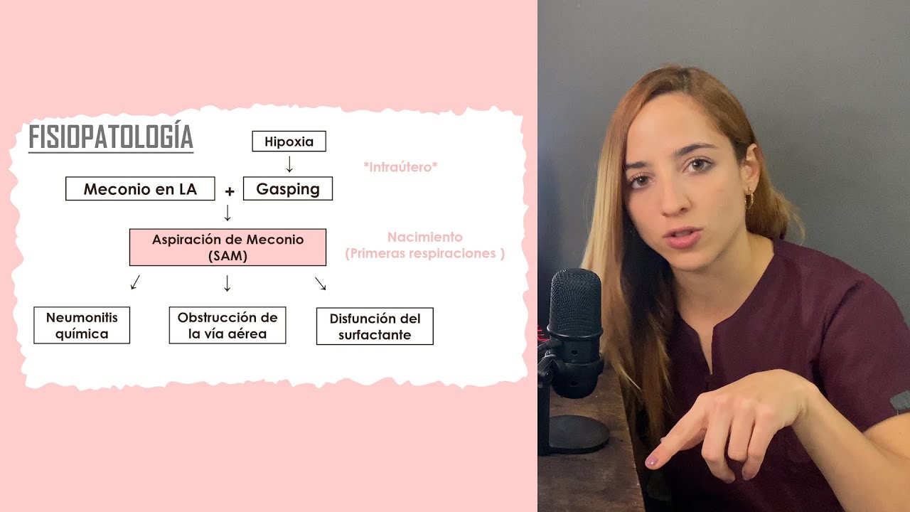 Síndrome de Aspiración Meconial (SAM) RECIÉN NACIDO PATOLOGÍA RESPIRATORIA | Mentes Médicas