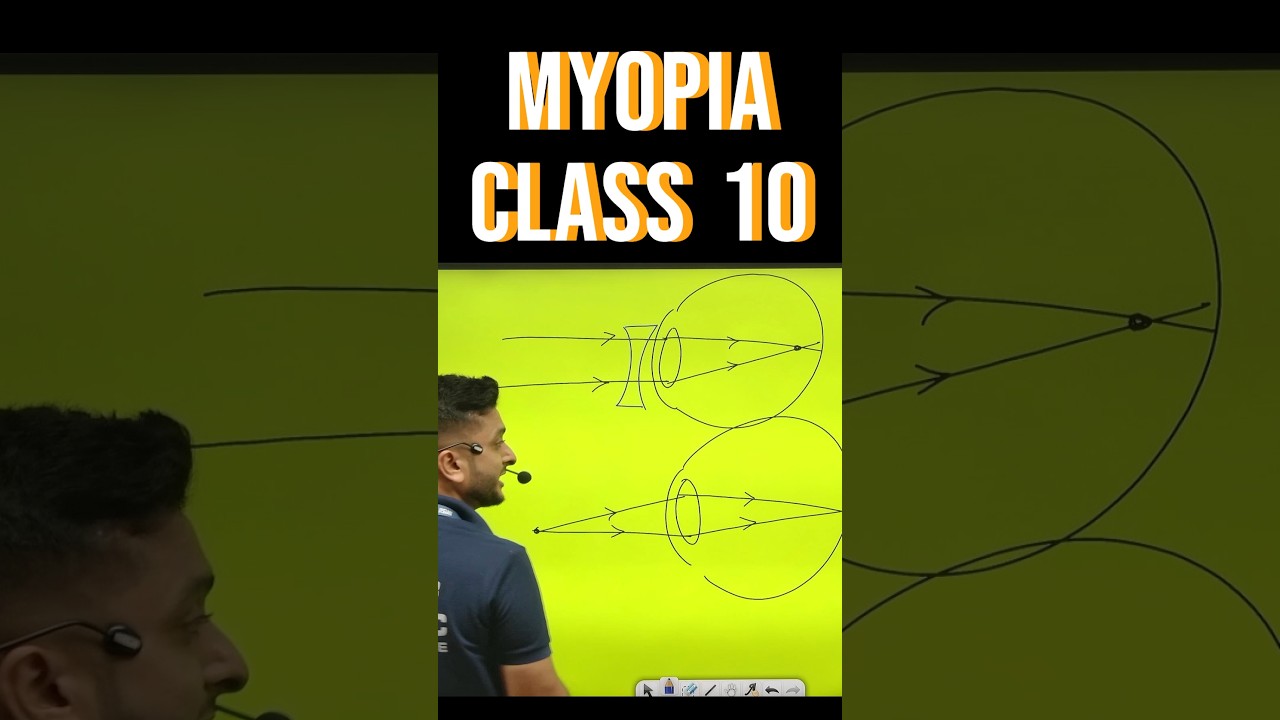 Myopia | Human eye and Colourful World |Science| Class 10 #myopia #humaneyeandcolorfulworld #science