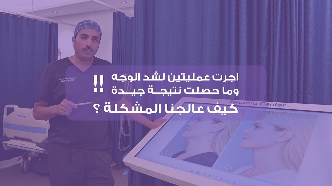 تصحيح شد الوجه والرقبة بعد 3 عمليات سابقة | Revision Facelift | الدكتور لؤي السالمي