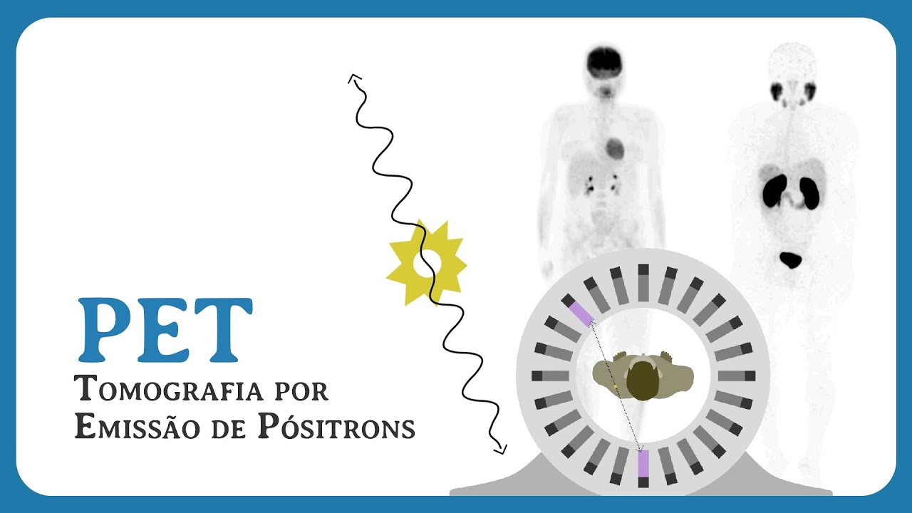 PET   Tomografia por Emissão de Pósitrons
