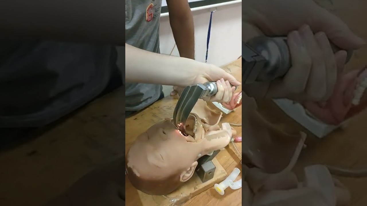 تدريب التخدير ..تركيب ال endotracheal tube د وليد طارق