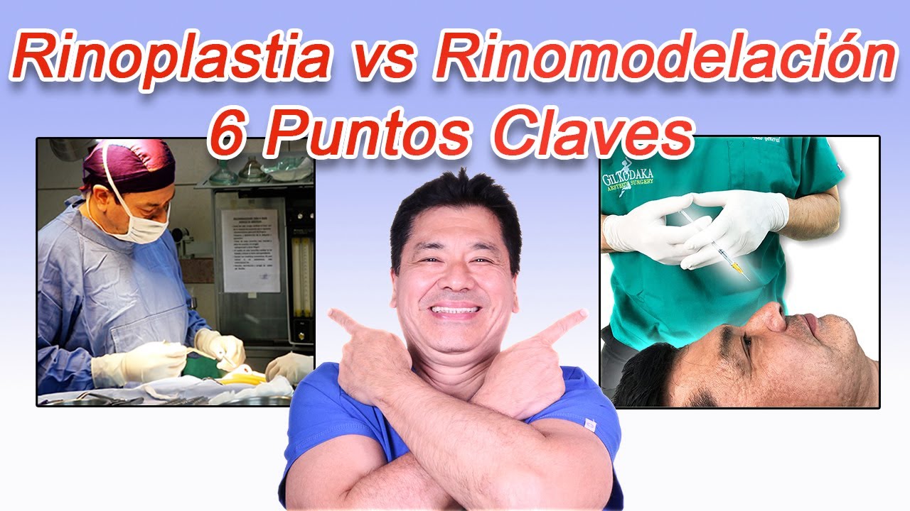 Rinoplastia vs Rinomodelación - 6 Puntos Claves