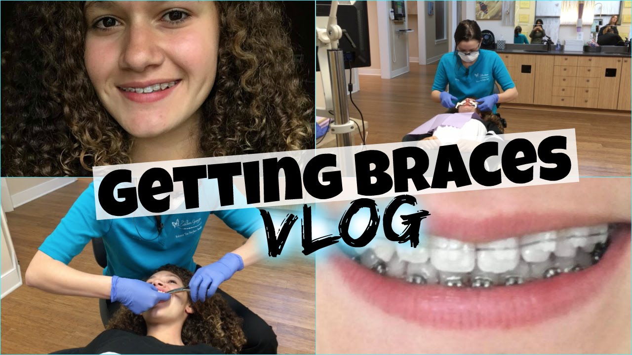 Getting Braces Vlog