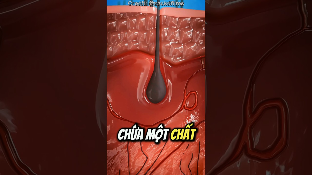 Why Do You Have Acne 😱 (Acne)