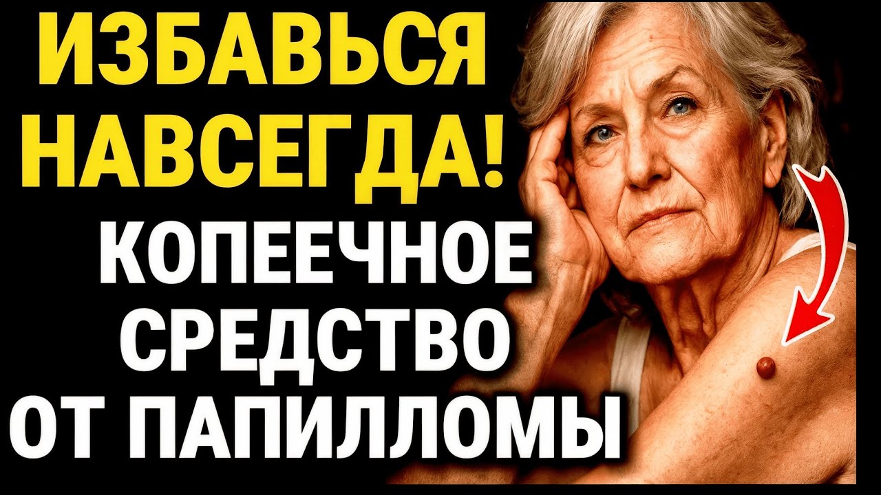 ПАПИЛЛОМЫ УХОДЯТ САМИ! Это ПЕРВЫЙ признак, что внутри вас ПАРАЗИТЫ! ЗДОРОВЬЕ ПОЖИЛЫХ