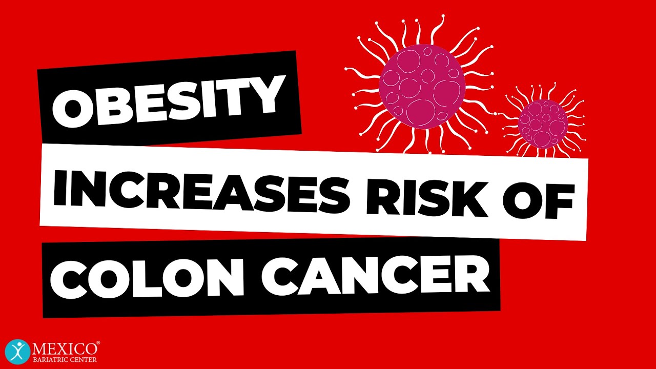 Obesity Increases Risk of Colon Cancer