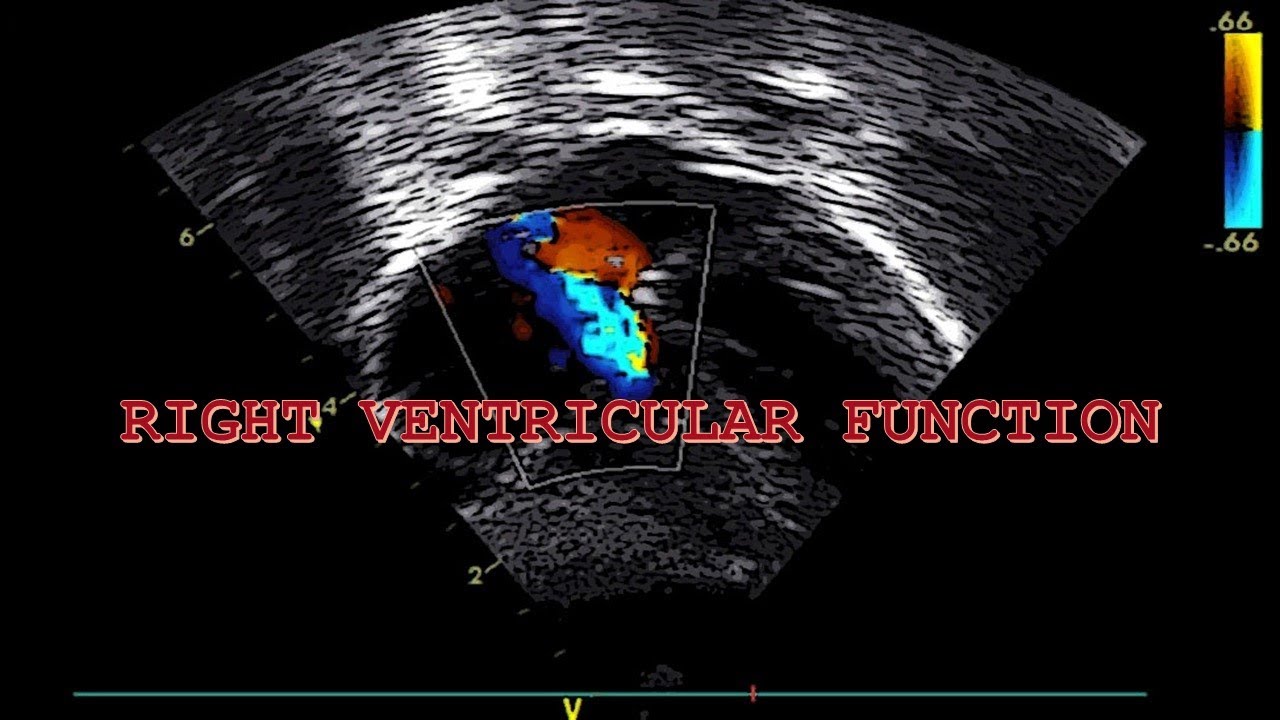 ECHOCARDIOGRAPIC EVALUATION OF HEMODYNAMICS IN NEONATES (PART 4/5). RIGHT VENTRICULAR FUNCTION