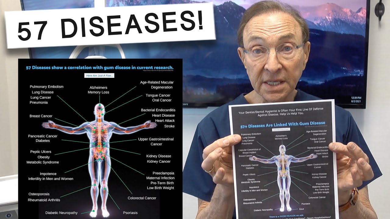 This ONE Disease is LINKED to 57+ other Systemic Diseases!
