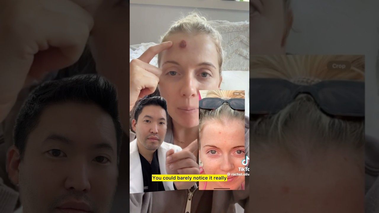 Dermatologist Explains Basal Cell Carcinoma Skin Cancer
