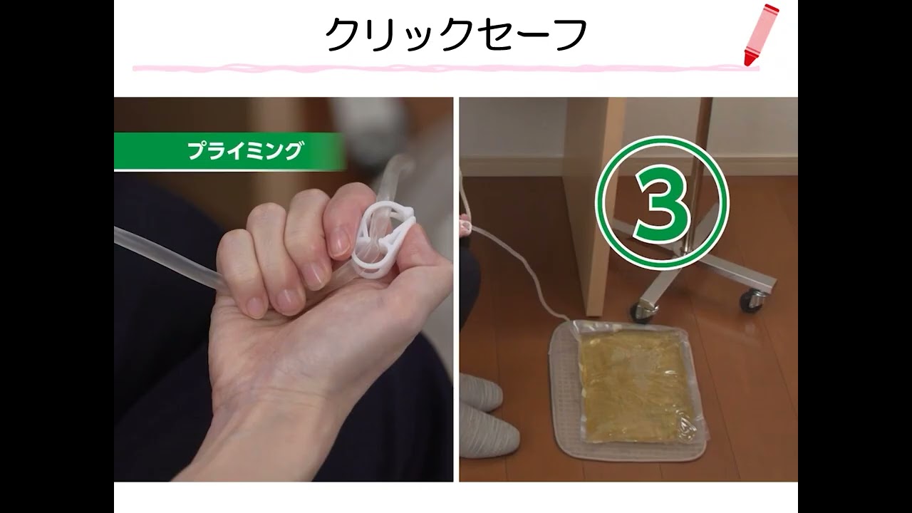 腹膜透析②