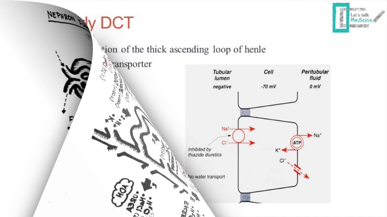 Hyponatremia
