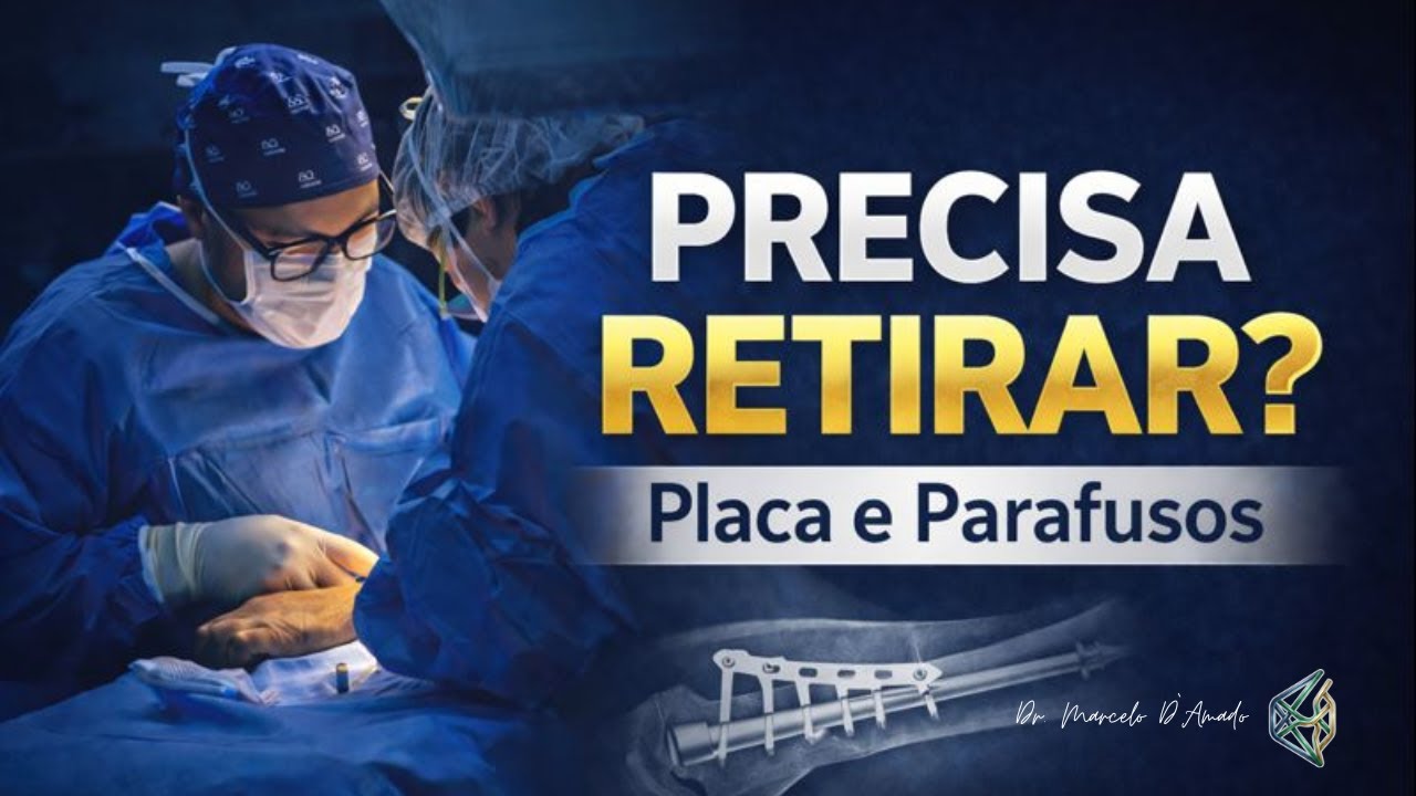 Retirada de Placa e Parafusos: quando é necessário retirar o material ortopédico?