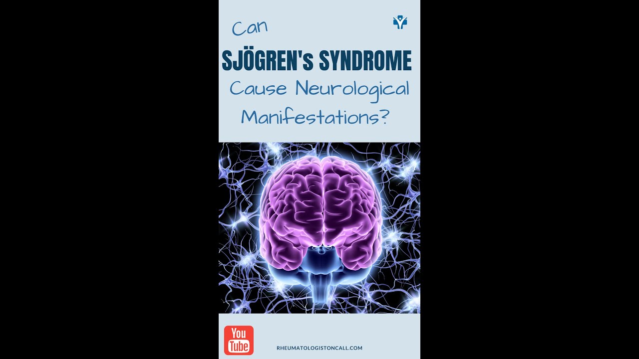 How can Sjogren's Syndrome affects your brain and peripheral nervous system?