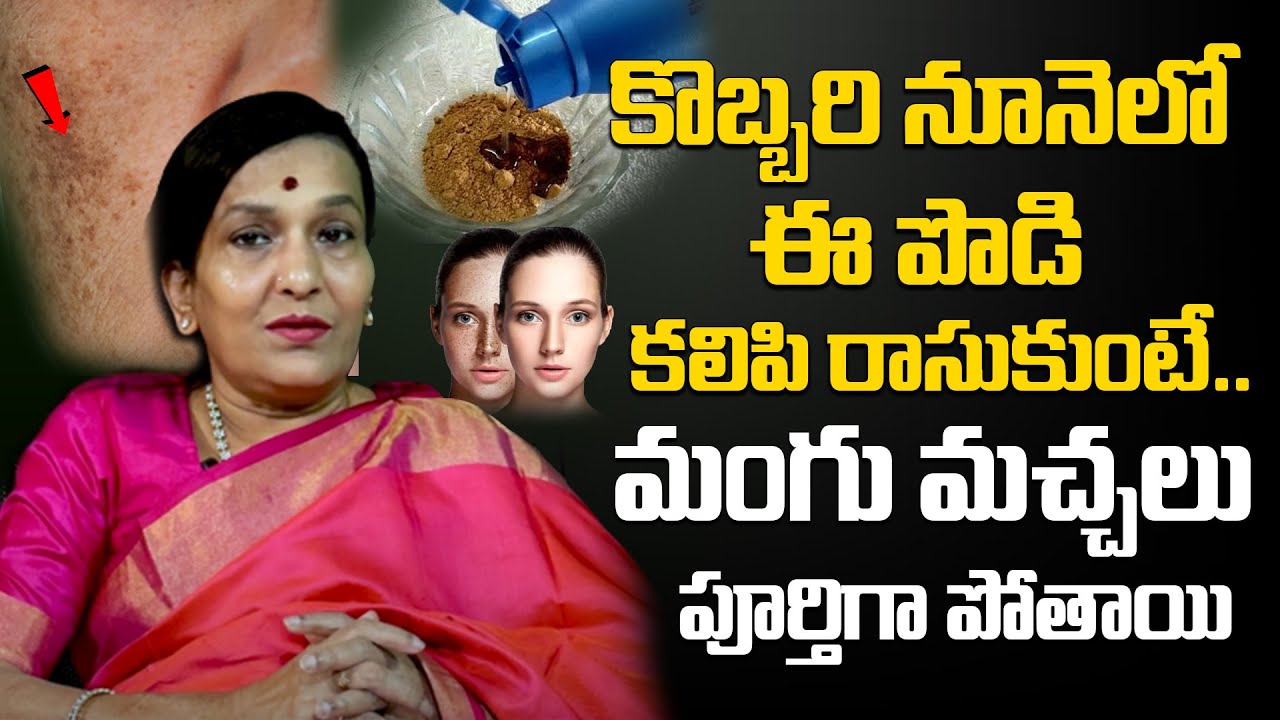 మంగు మచ్చలు పూర్తిగా పోవాలంటే.. | Pigmentation Problem Solution | Dr Uma Venkatesh | Pulse Balancing