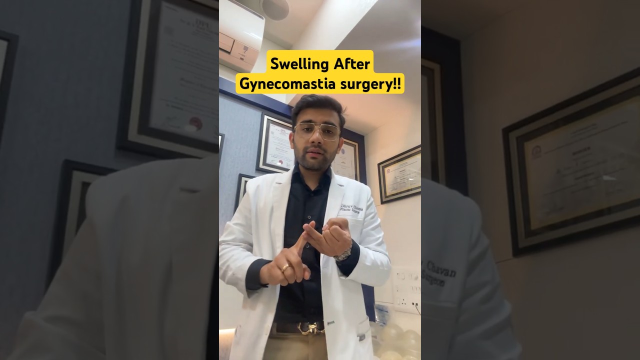 Seroma After Gynecomastia Surgery? Complication Explained by Dr Dhruv Chavan #gynecomastiatreatment