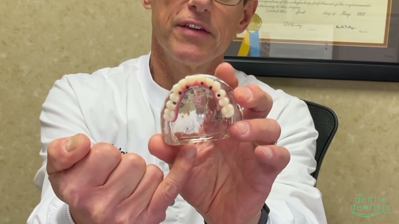 Understanding Dentures pt2: Fixed Hybrid Benefits | The Gentle Dentists | Shelby Township, MI