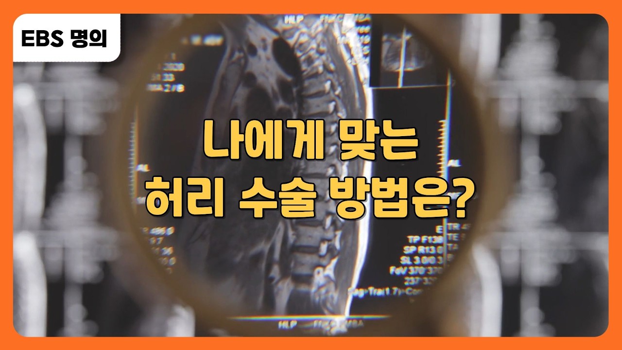 나에게 맞는 허리 수술 방법은? |  #EBS건강