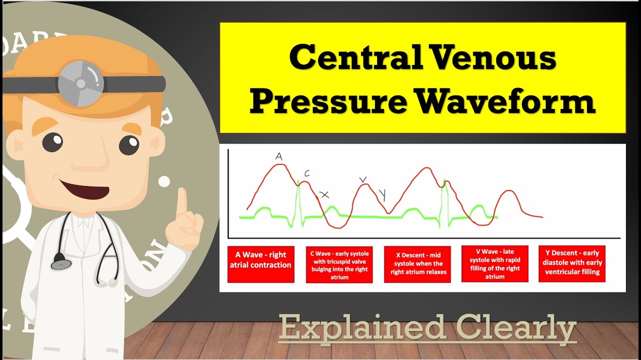 Central Venous Pressure (CVP) Waveform And Tracing Basics - A, C, X, V, Y Explained Clearly!
