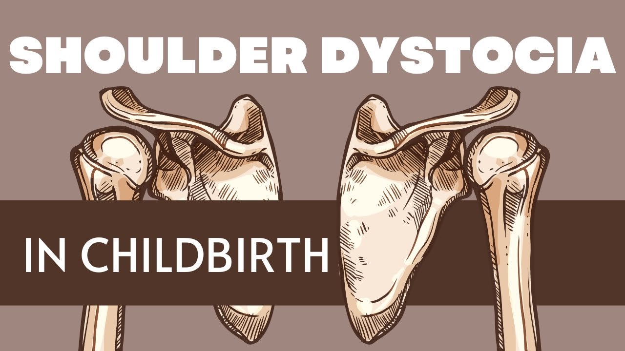Shoulder Dystocia (what to expect from a labor and delivery nurse)