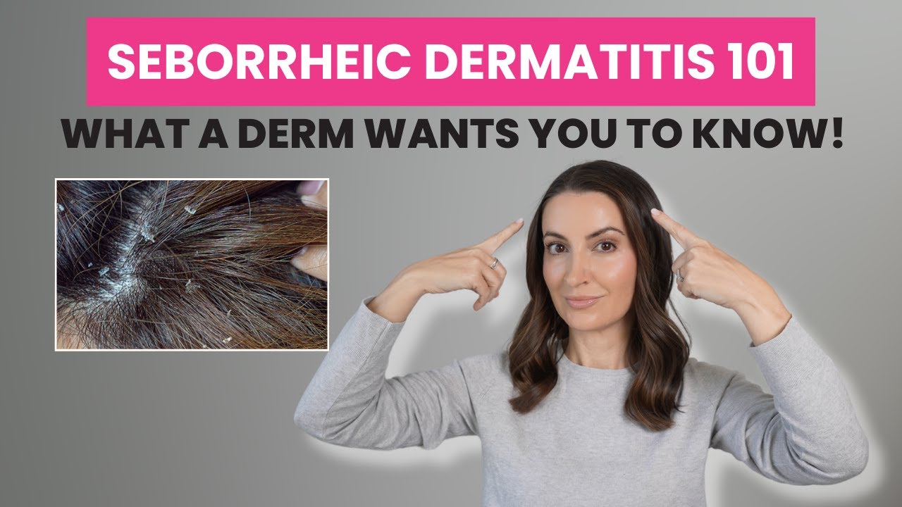 Seborrheic Dermatitis: 3 Dermatologist-Approved Tips to Manage Scalp Care | Dr. Aleksandra Brown