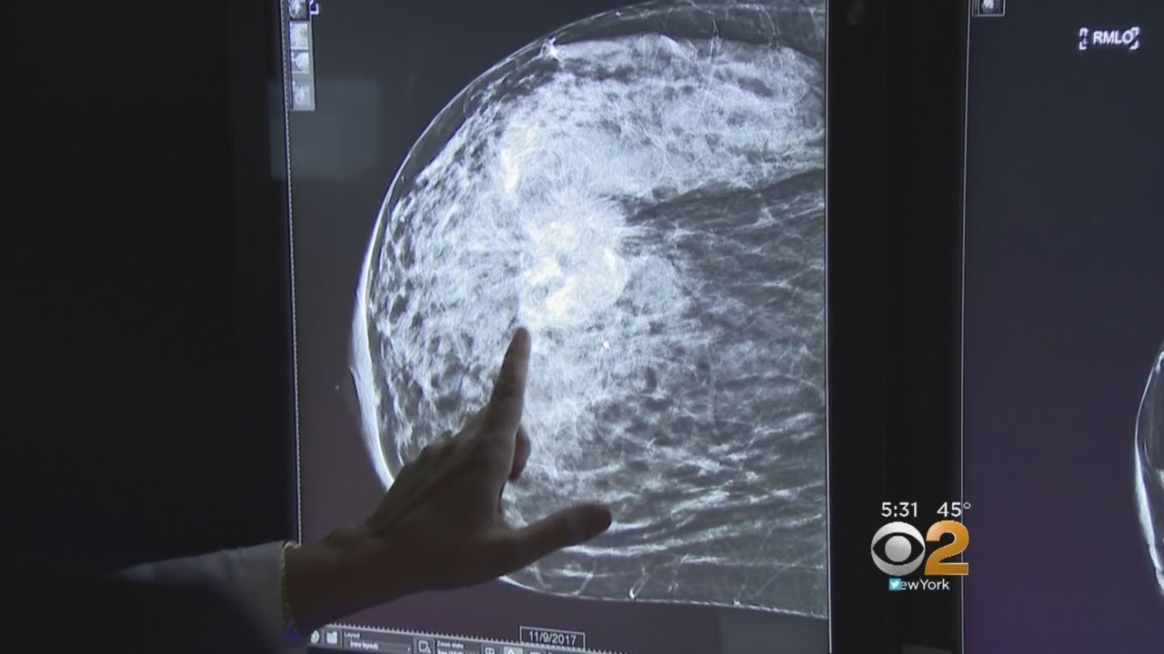 How Often Should A Woman Have A Mammogram?