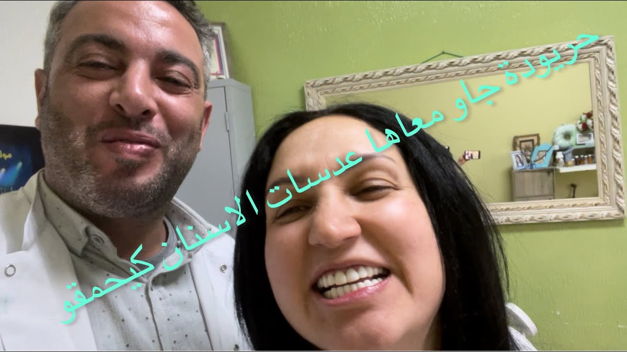 تجميل الابتسامة بعدسات الأسنان | قبل وبعد