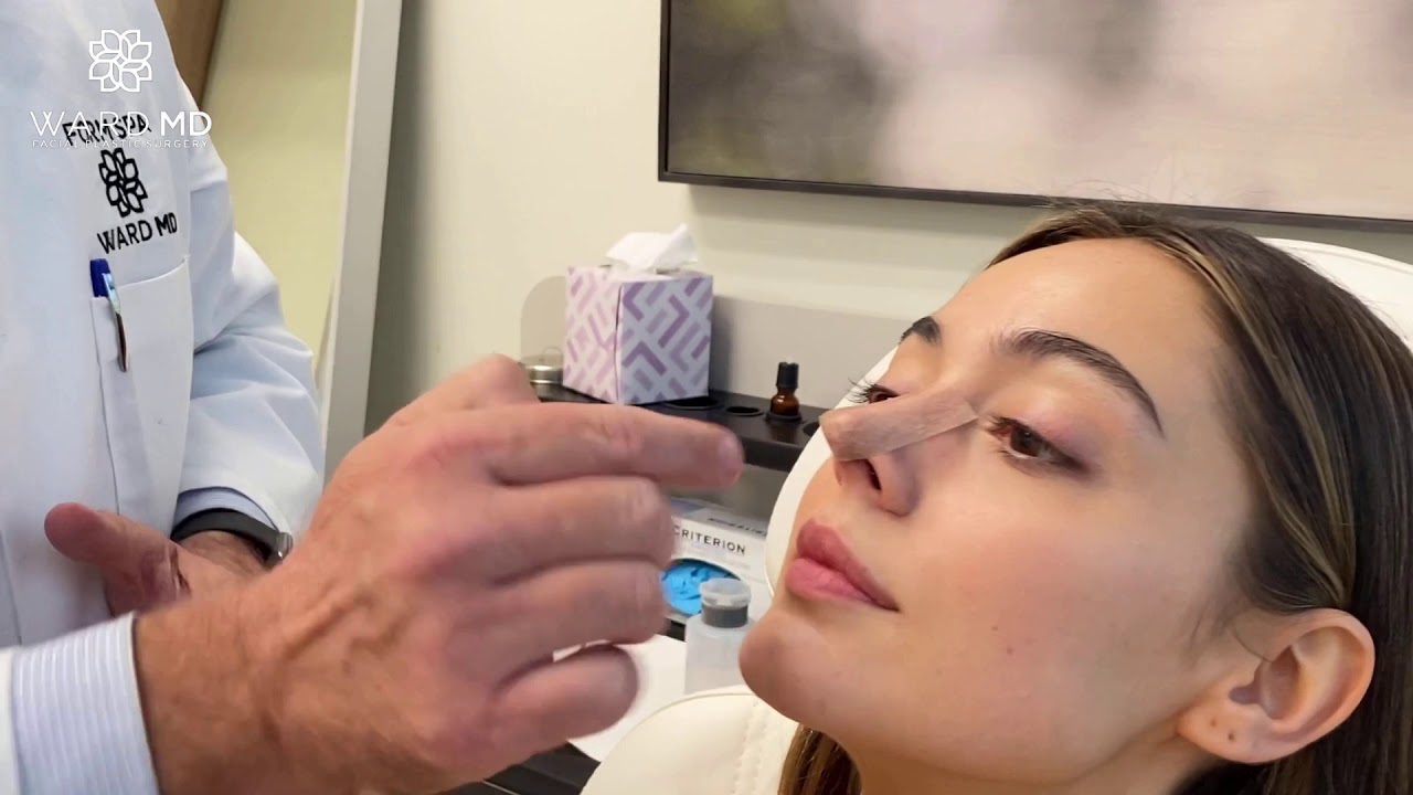 Taping a Nose to Reduce Swelling