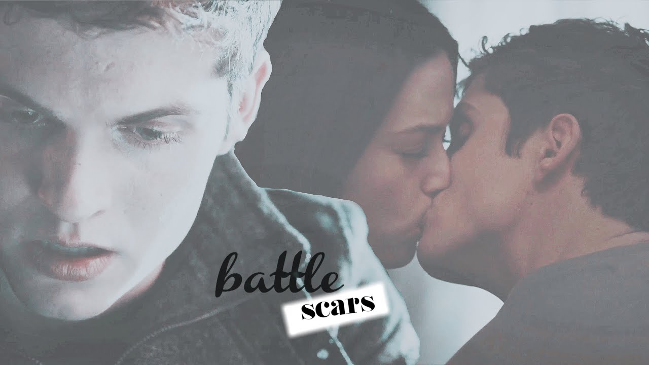 I & A | Battle Scars