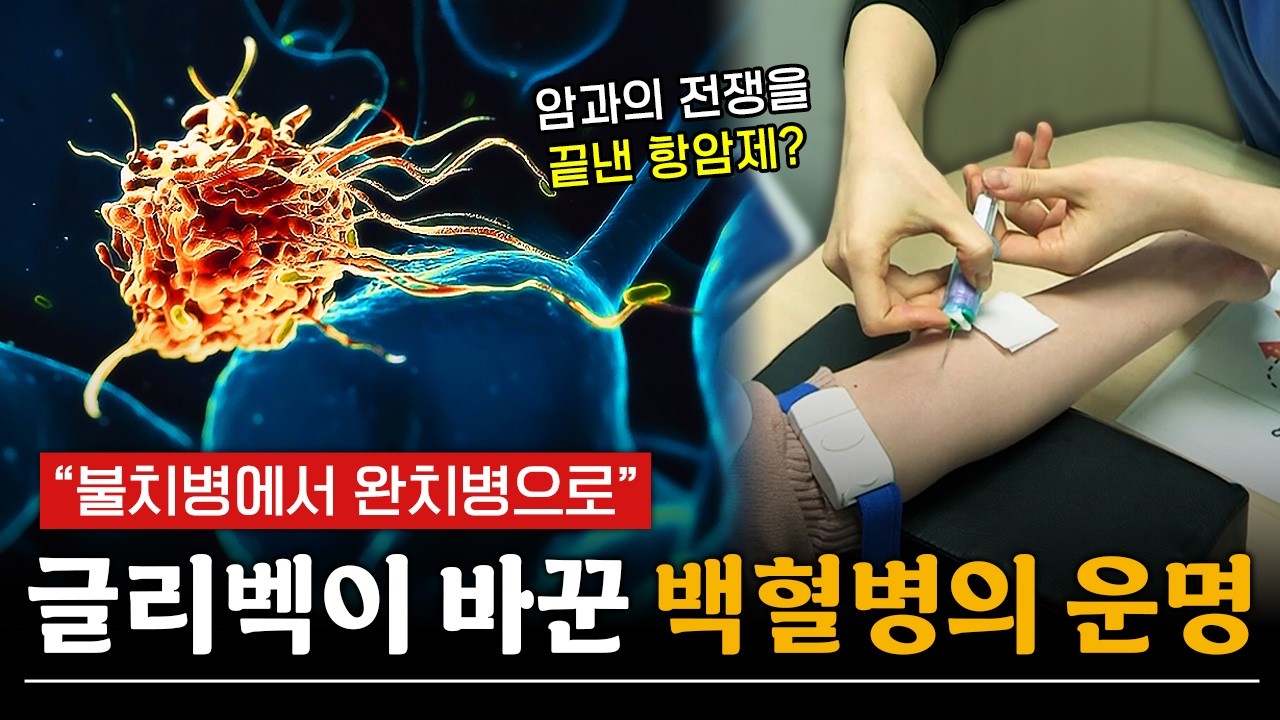 죽음의 병이던 만성골수성백혈병, 이제 완치가 보인다 ㅣ 메디컬 인사이트
