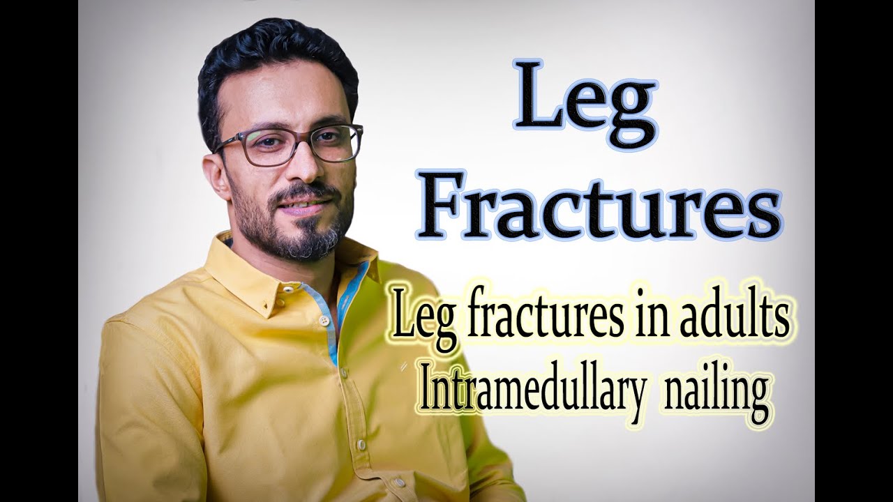 05 Leg fractures: Intramedullary nailing
