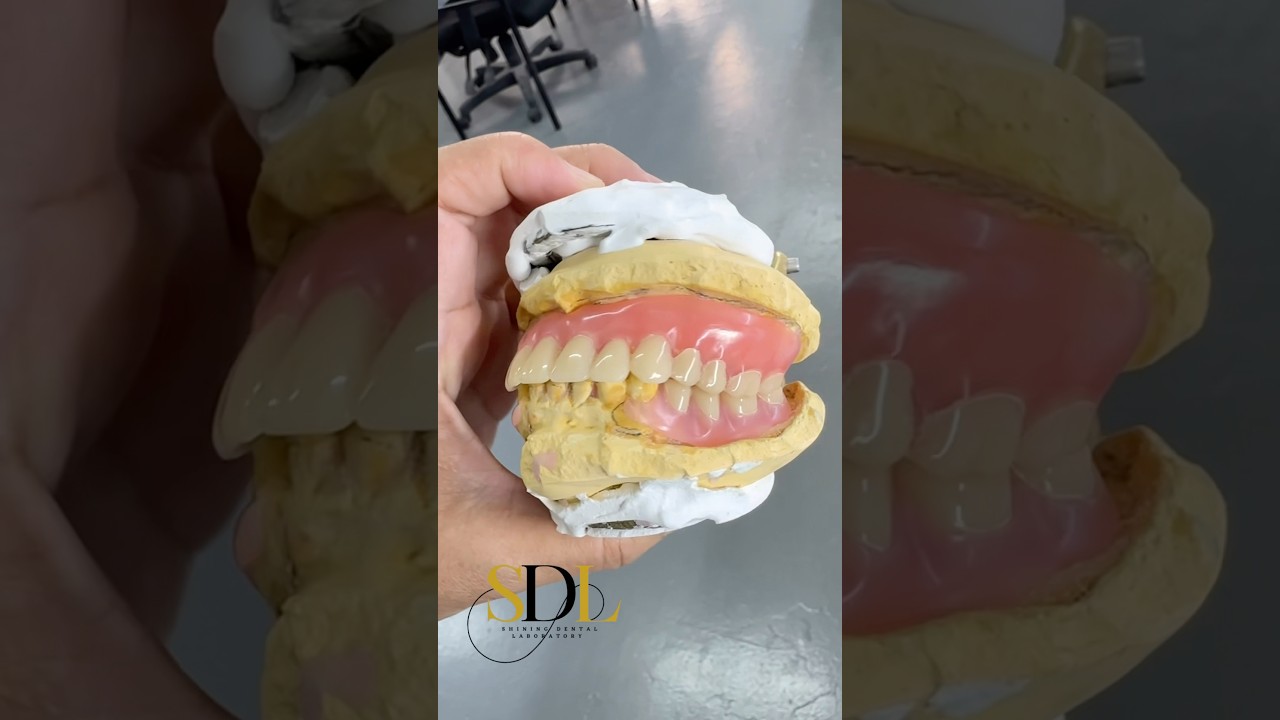 Valplast flexible denture #dentallab #valplast #gigipalsu #flexibledentures  more info +601133462064
