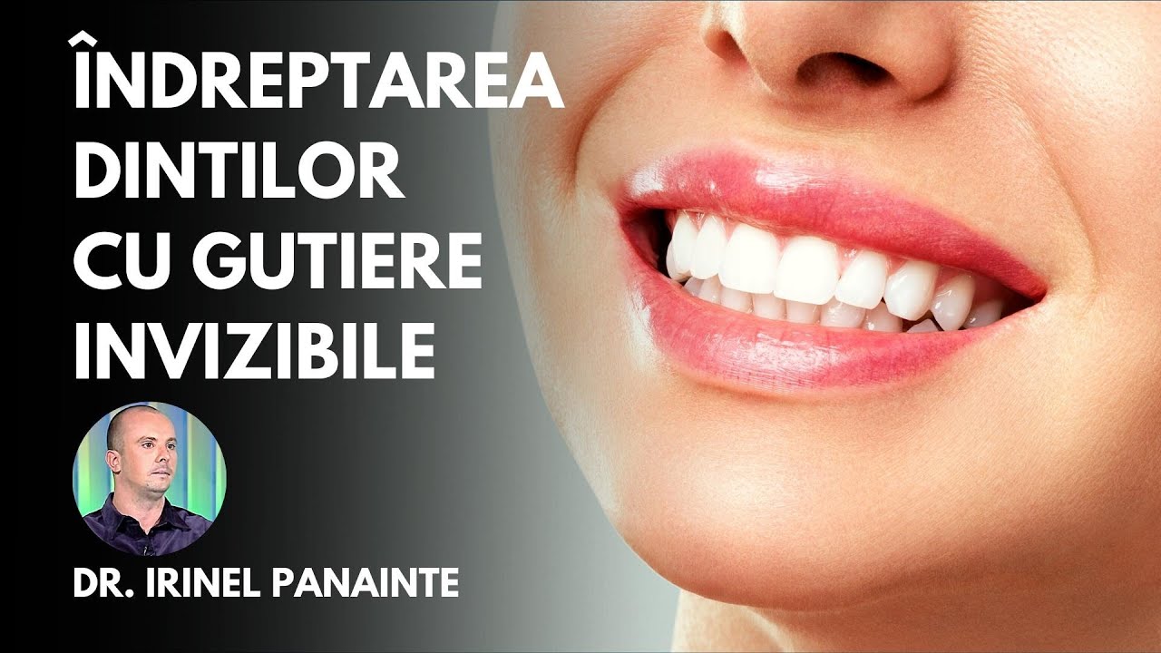Îndreptarea Dintilor cu Gutiere Invizibile | Dr. Irinel Panainte, Medic Specialist în Ortodonție