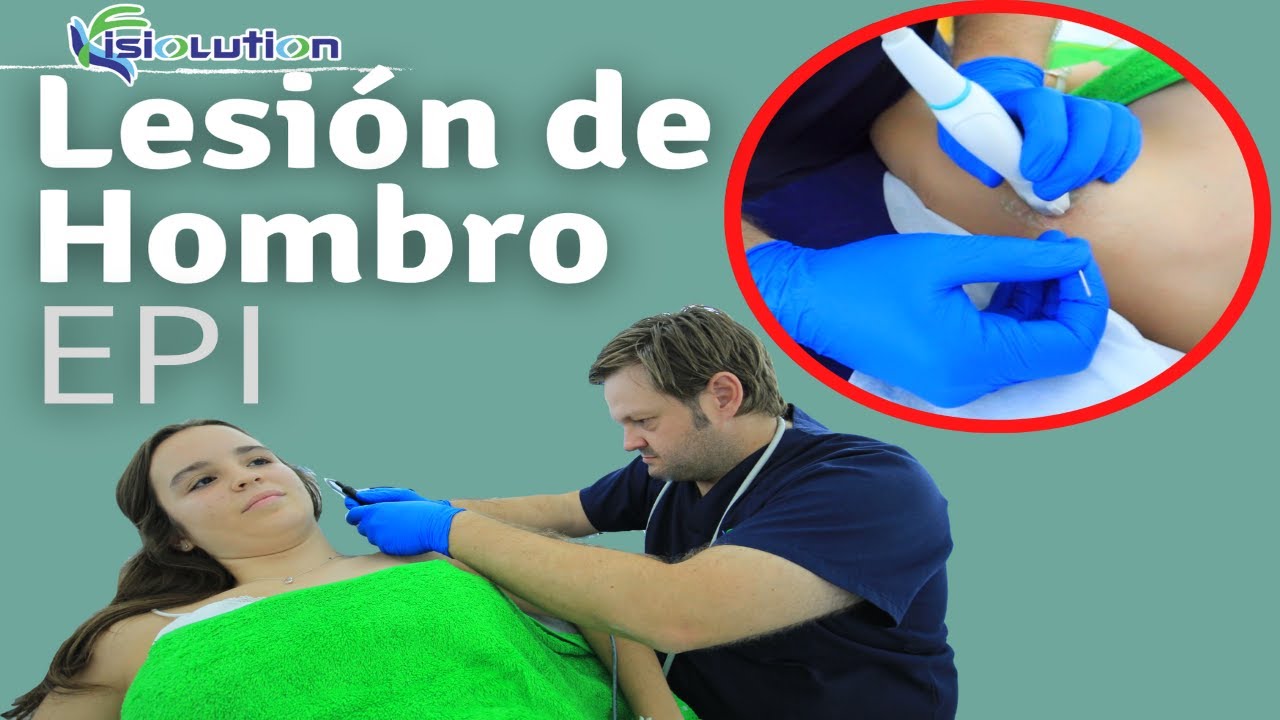 TRATAMIENTO EPI del HOMBRO LESIONADO Fisioterapia | Fisiolution