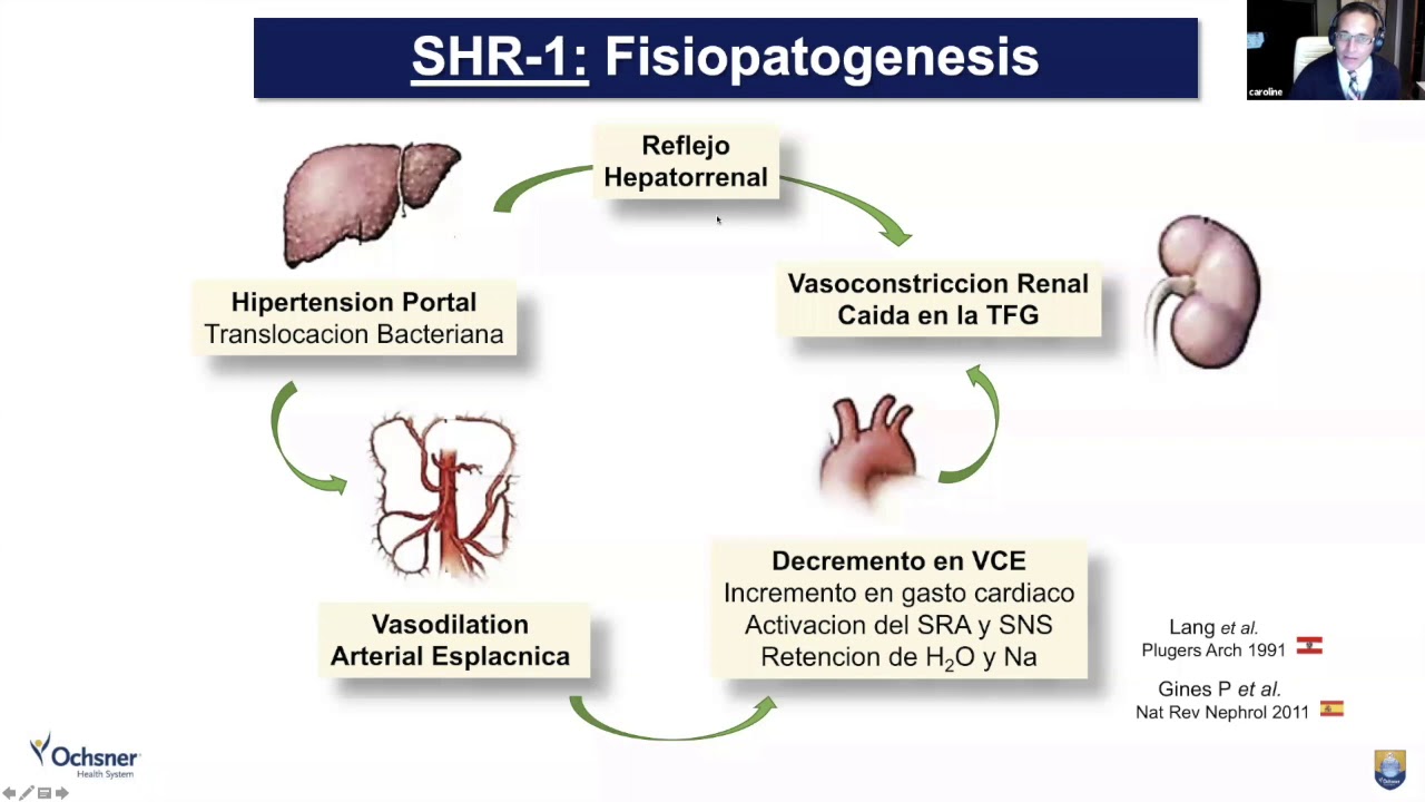 Dr. Juan Carlos Velez Sx Hepatorrenal